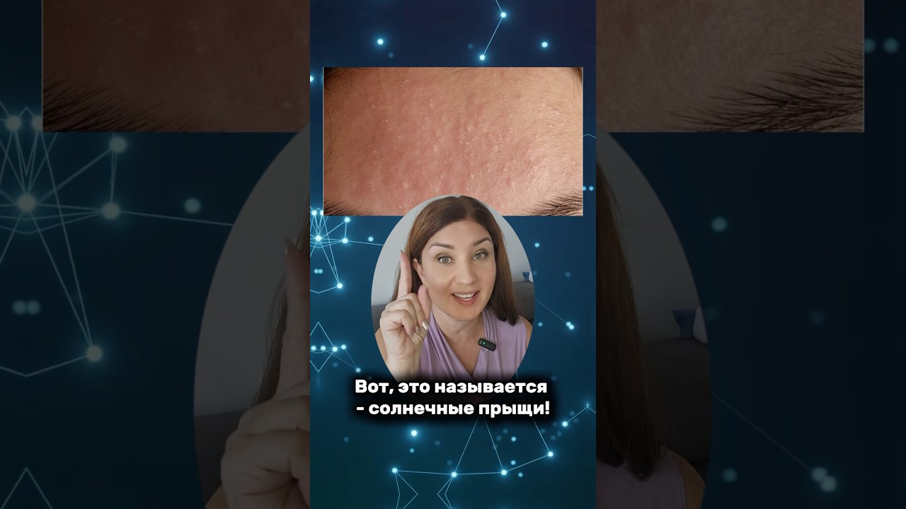 Солнце ПОДСУШИЛО? Жди сюрпризов через неделю. кожалица акне топ спф спф50 spf spf50