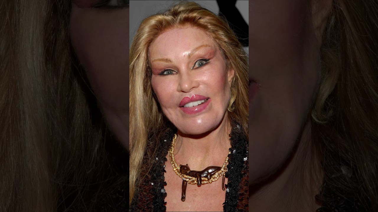 10 Worst Celebrity Plastic Surgery Fails That Shocked the World 😱  Part 1