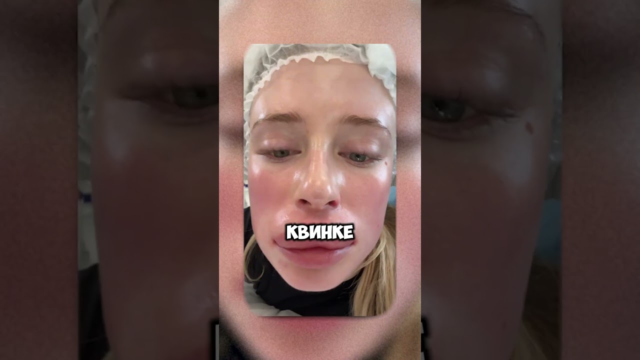 BLONDINKA DRIVE ЧУТЬ НЕ УМЕРЛА #shorts #blondinkadrive #блондинкадрайв #блогер #блогеры