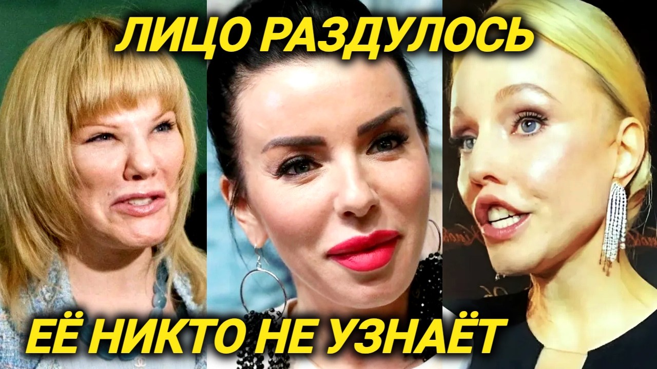 Изменилась до НЕУЗНАВАЕМОСТИ. Звезды 2025 ДО и ПОСЛЕ пластических операций