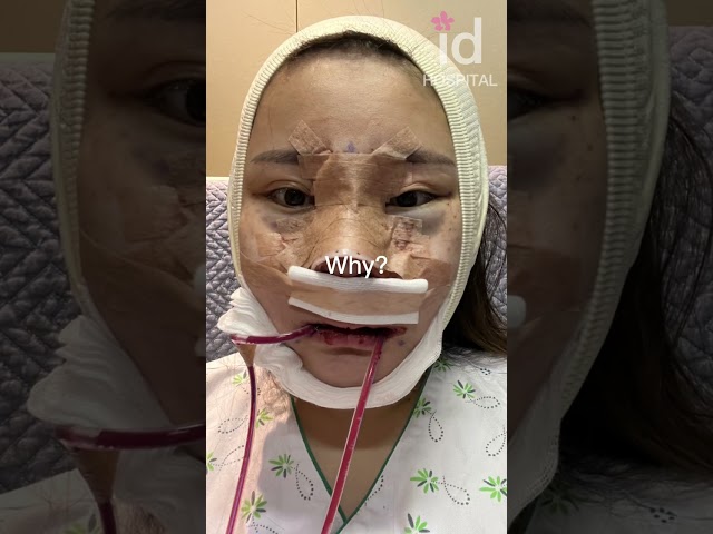 Plastic surgery transformation in Korea idhospital shorts