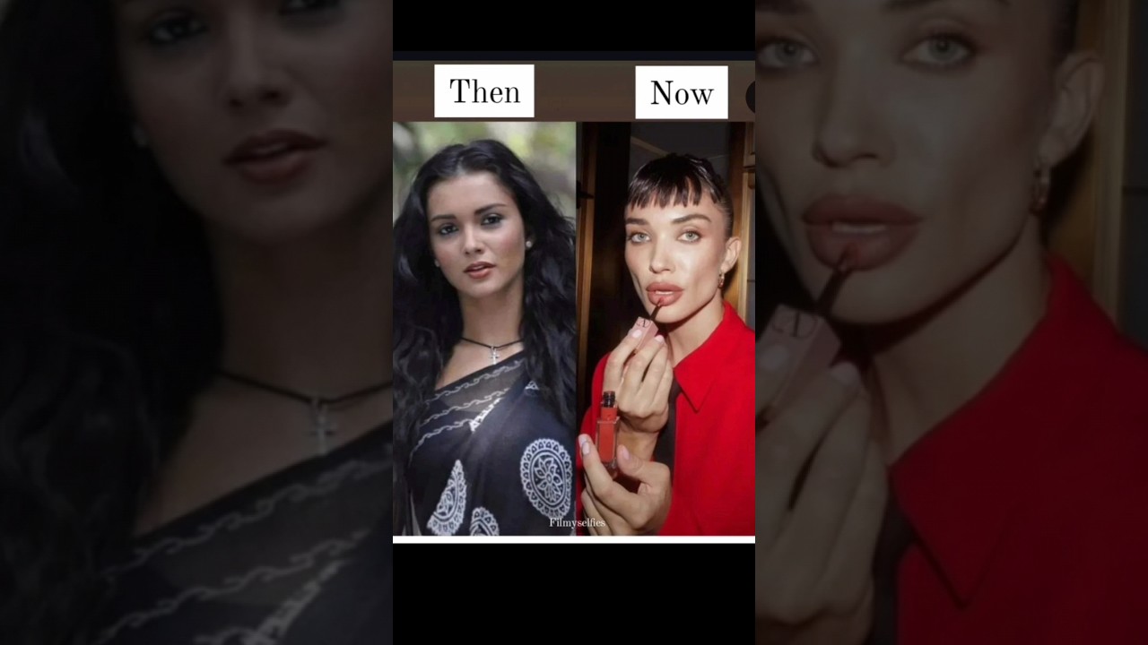 3 Failed Plastic Surgeries In Bollywood #shorts #bollywood #youtubeshorts