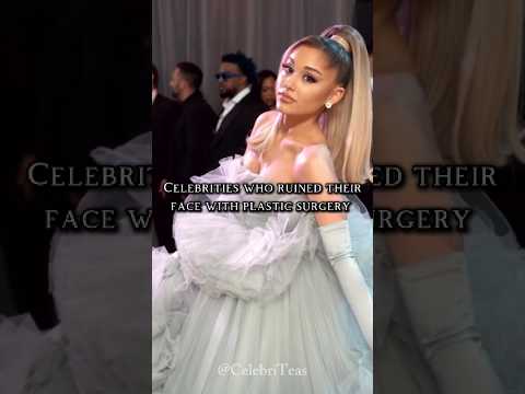 Celebrities Who Ruined Their Face With Plastic Surgery 🥀