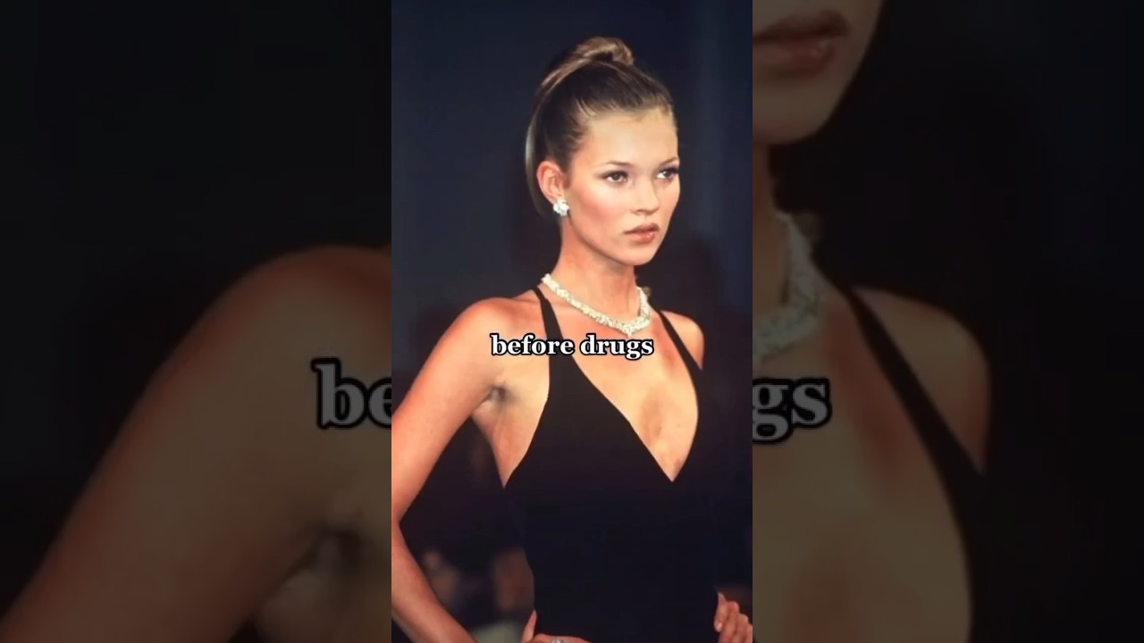 Before Drugs &amp; After #Katemoss #model #catwalk #shortfeed #supermodel #celebrities